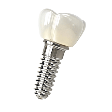 Імплантація зубів